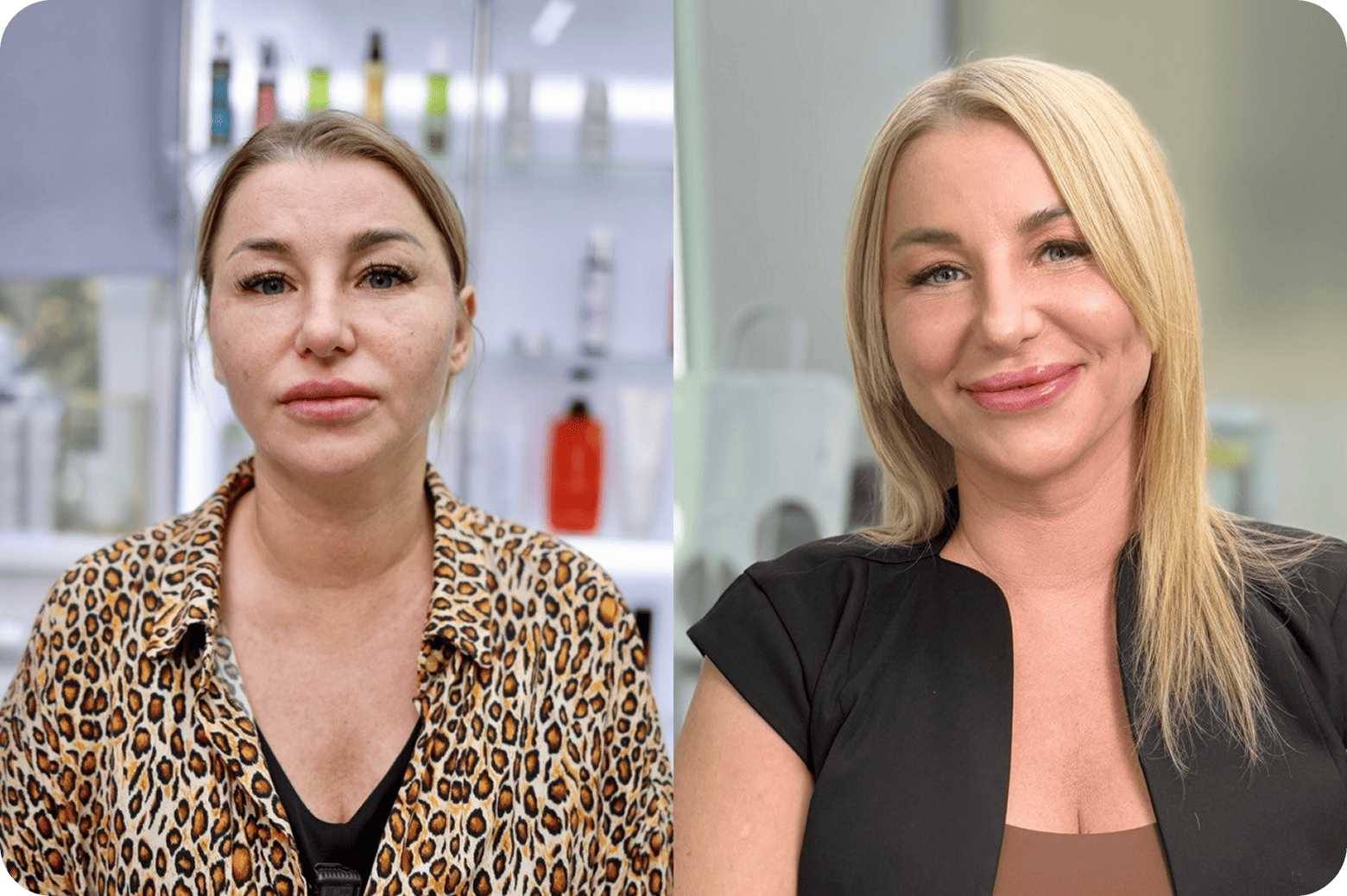 Результат процедуры